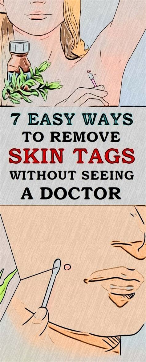 7 easy ways to remove skin tags without seeing a doctor health and fitness articles health