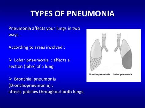 Pneumonia Types
