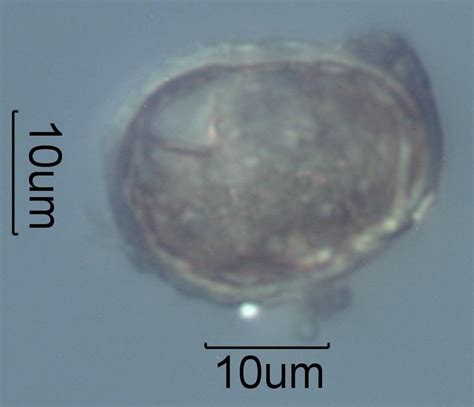 Mite Egg Under The Microscope