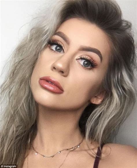 Ashly Schwan Reveals Ordeal With Botched Lip Fillers Daily Mail Online