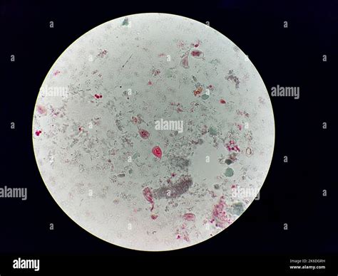 A Parasite Under Microscope X1000 Giardia Lamblia Stock Photo Alamy