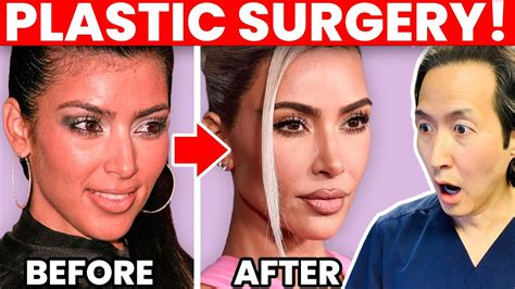 KIM KARDASHIAN Plastic Surgery Transformation Cosmetic Surgeon Reacts