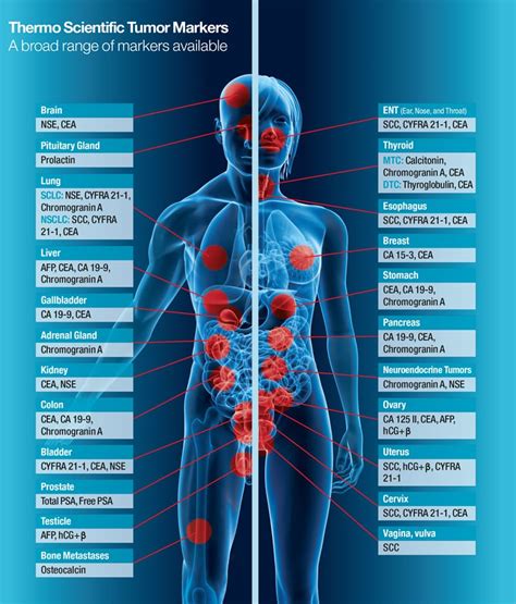 Oncology Brahms Gmbh