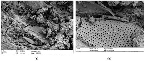 Microscopic Structure Diatomaceous Earth