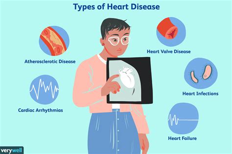 Das Herz Anatomie Funktion Und Bedingungen Medde