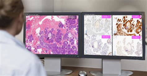 How To Choose A Digital Pathology Slide Scanner