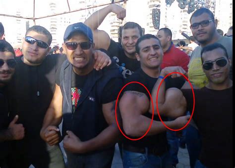 The Grossest Synthol Freaks On The Internet