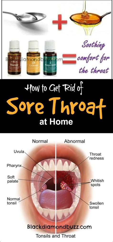 How To Get Rid Of Sore Throat Fast