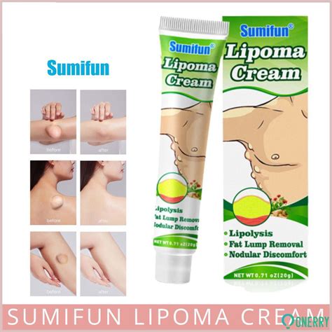Sumifun Lipoma Removal Cream Original Lipoma Ointment Lump Fat Lump Removal Onerryph Shopee