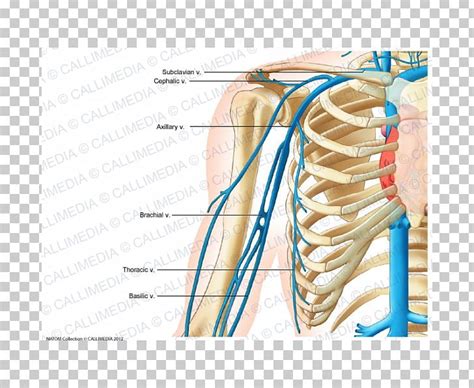 Subclavian Picc Line