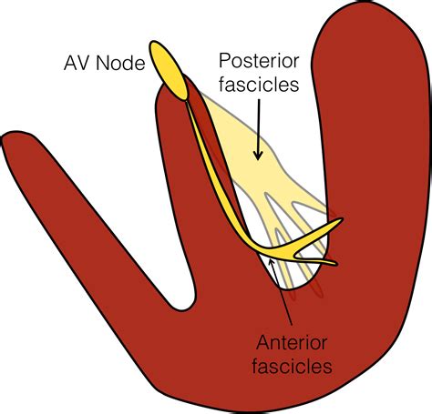 The Boring Guide To Ecgs Fascicular Blocks Canadiem