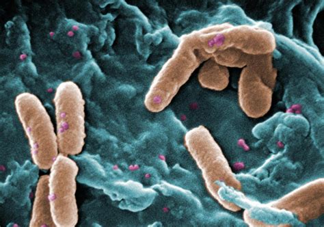 Infección Bacteriana En Pacientes Con Covid 19 Cochrane Iberoamérica