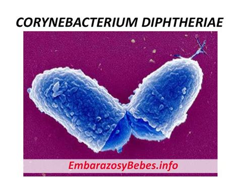 La Difteria Síntomas Causas Toxinas Vacunas y Tratamiento