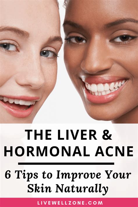 The Liver And Hormonal Acne 6 Powerful Tips For Clear Skin Hormonal