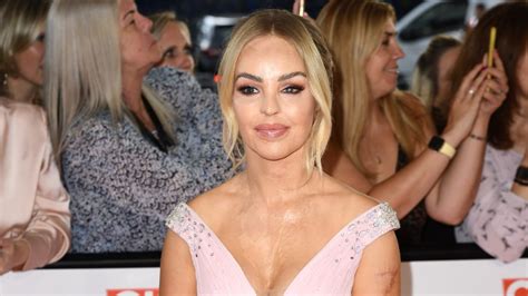 Katie Piper Before And After An Acid Attack Left Her Permanently
