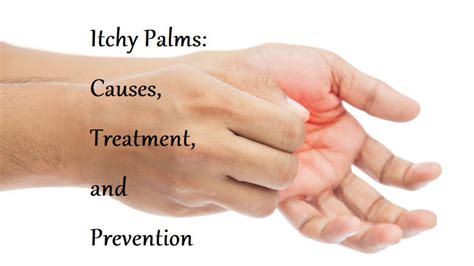 Itchy Palms 10 Causes Symptoms And Treatment