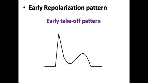 Ecg Course Stemi Or Early Repolarization Pattern Dr Sherif Altoukhy