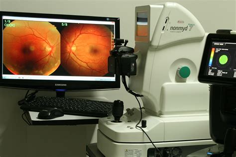 Retinal Photography Retinal Tears Diagnosis And Treatment