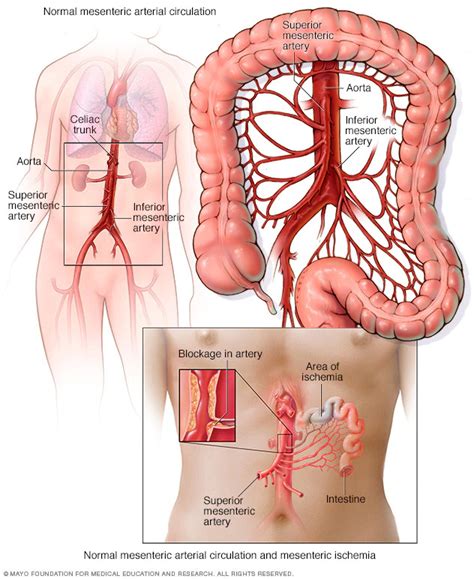 Mesenteric Artery Bypass My XXX Hot Girl