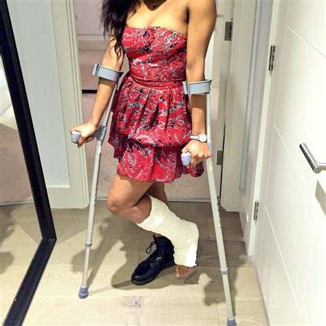 Kiara On Twitter The Stunning Thelondonhughes On Crutches