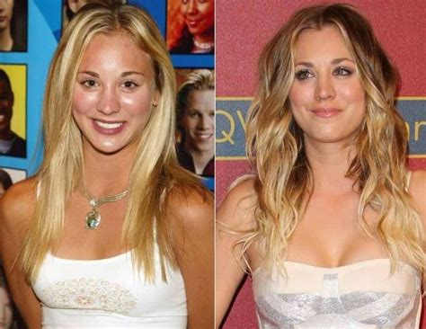 Kaley Cuoco Admits Nose Plastic Surgery And Breast Implants