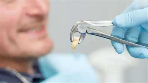 Tips To Speed Up Tooth Extraction Healing Integrated Smiles Bendigo