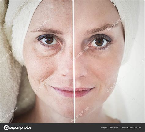 Beauty Concept Skin Care Anti Aging Procedures Rejuvenation Stock