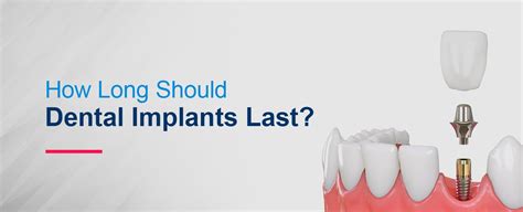Dental Implants How Long Should They Last Hiossen® Implant