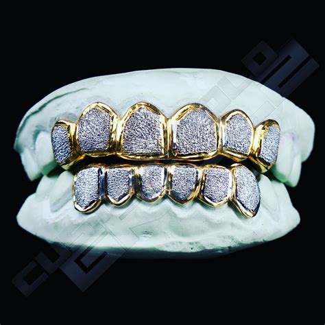 Diamond Teeth Grillz Gold Grillz Gold Teeth