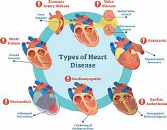 Beat Heart Disease With Fishkills Top Rated Specialists