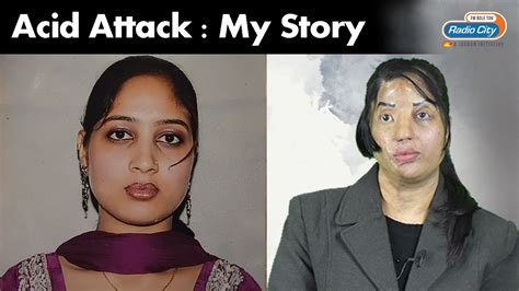Acid Attack Survivor Amanpreet Kaur Its My Story Radio City