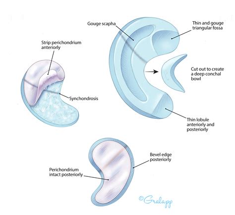 External Ear Oto Surgery Atlas