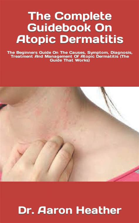 Buy The Complete Guidebook On Atopic Dermatitis The Beginners Guide On The Causes Symptom