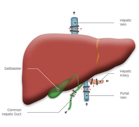 Lahey Transplant Liver Recipient