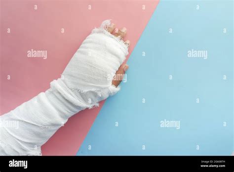 Injured Painful Hand With Bandage Stock Photo Alamy