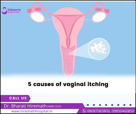 Top Causes Of Vaginal Itching