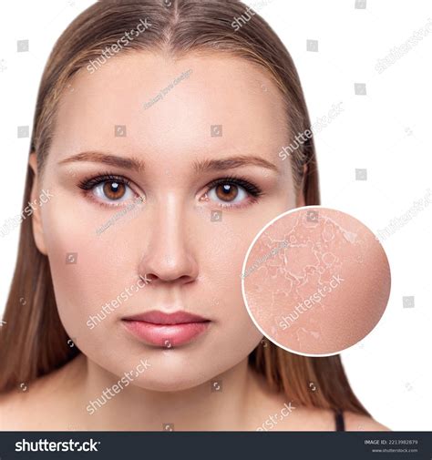 139 Young Woman Zoom Circle Shows Dry Facial Images Stock Photos