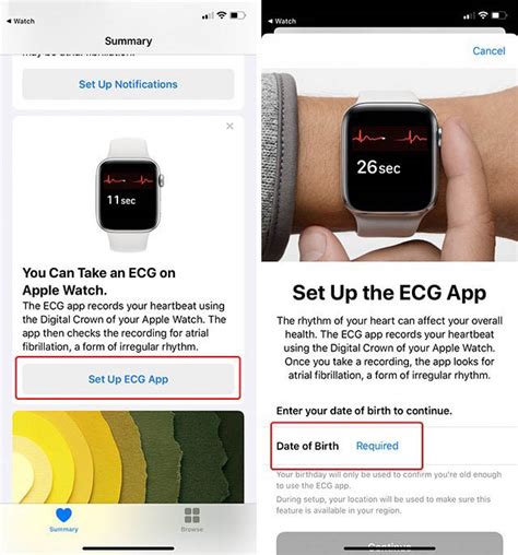 How To Use The Apple Watch Ecg Feature Effectively Moyens Io