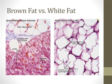 Ppt Brown Fats Potential For Solving The Obesity Problem Powerpoint