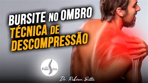 BURSITE no OMBRO FISIOTERAPIA TÉCNICA DESCOMPRESSIVA SUBACROMIAL