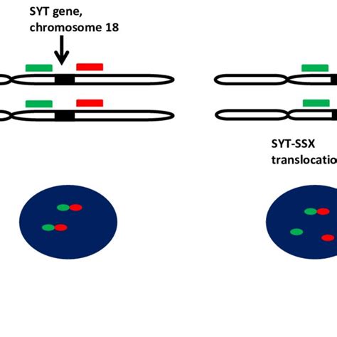 Syt Gene Translocation In Chromosome 18 At The Top Left 2 Probes Were