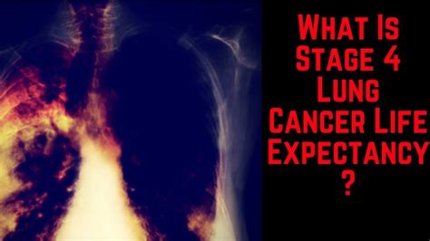 Designprolaw Metastatic Lung Cancer Life Expectancy