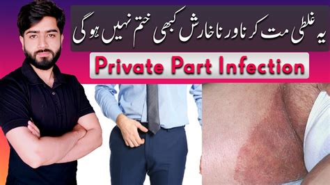 jock itch treatment tinea cruris private part itch babar ali hashmi youtube