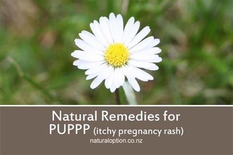 Natural Remedies For Puppp Itchy Pregnancy Rash Were Having A Boy
