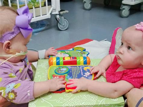 Conjoined Twins Allison And Amelia Photo 12 Pictures Cbs News