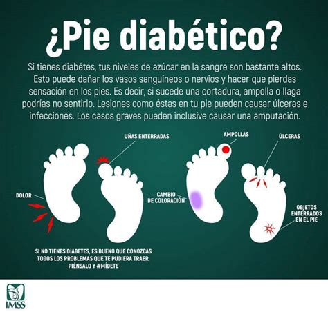 IMSS Chihuahua emite recomendaciones para los cuidados de pie diabético Noticias Chihuahua