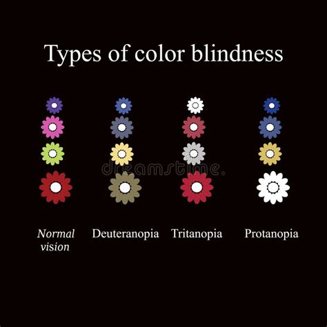 Types Of Color Blindness Eye Color Perception Stock Vector