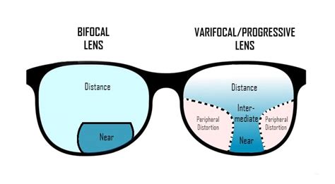 Progressive Lenses Vs Bifocal Lenses Endmyopia The Reduced Lens
