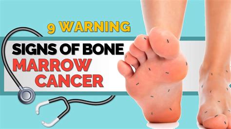 9 Warning Signs Of Bone Marrow Cancer Youtube