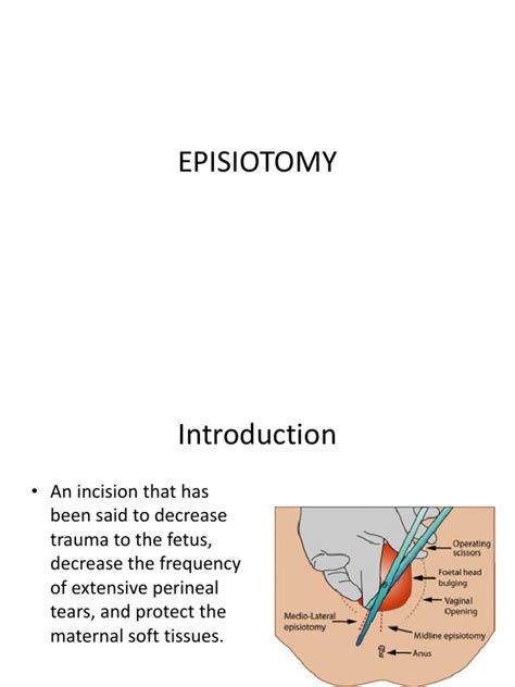 Episiotomy Teaching Pdf Clinical Medicine Medical Specialties